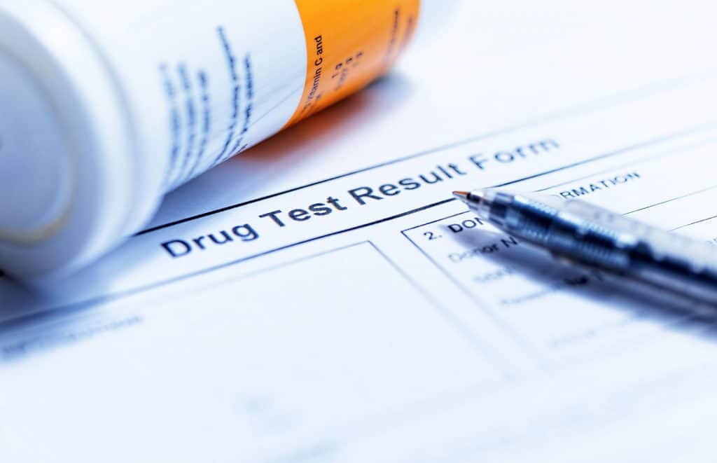 drug test results